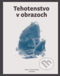 Kniha: Tehotenstvo v obrazoch (Michal Holáň a kolektív). Fortuna Libri, 2018 Kniha: Tehotenstvo v obrazoch (Michal Holáň a kolektív). Fortuna Libri, 2018