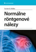 Kniha: Normálne röntgenové nálezy (Torsten B. Möller). Grada, 2026 Kniha: Normálne röntgenové nálezy (Torsten B. Möller). Grada, 2026