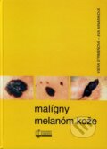 Kniha: Malígny melanóm kože (Eva Minariková a Viera Strmeňová). Osveta, 2005 Kniha: Malígny melanóm kože (Eva Minariková a Viera Strmeňová). Osveta, 2005