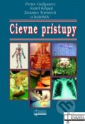 Kniha: Cievne prístupy (Peter Gašparec a kolektiv). Osveta, 2009 Kniha: Cievne prístupy (Peter Gašparec a kolektiv). Osveta, 2009