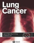 Kniha: Lung Cancer (Jack A. Roth, James D. Cox a Waun Ki Hong). Wiley-Blackwell, 2008 Kniha: Lung Cancer (Jack A. Roth, James D. Cox a Waun Ki Hong). Wiley-Blackwell, 2008
