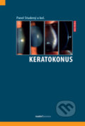 Kniha: Keratokonus (Pavel Studený). Maxdorf, 2021 Kniha: Keratokonus (Pavel Studený). Maxdorf, 2021