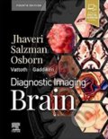 Kniha: Diagnostic Imaging: Brain (Miral D. Jhaveri). Elsevier Science, 2020 Kniha: Diagnostic Imaging: Brain (Miral D. Jhaveri). Elsevier Science, 2020