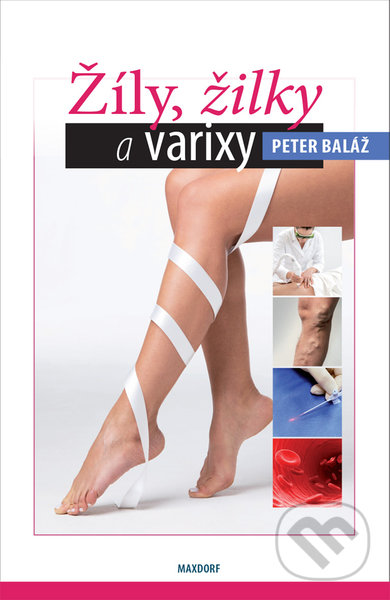 Kniha: Žíly, žilky a varixy (Peter Baláž). Maxdorf, 2021 Kniha: Žíly, žilky a varixy (Peter Baláž). Maxdorf, 2021