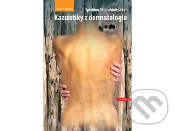 Kniha: Kazuistiky z dermatologie (Spyridon Gkalpakiotis). Maxdorf, 2021 Kniha: Kazuistiky z dermatologie (Spyridon Gkalpakiotis). Maxdorf, 2021