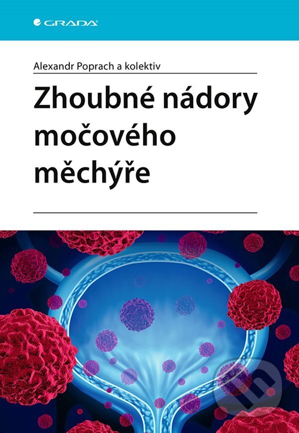 E-kniha: Zhoubné nádory močového měchýře (Alexandr Poprach). Grada, 2021 E-kniha: Zhoubné nádory močového měchýře (Alexandr Poprach). Grada, 2021