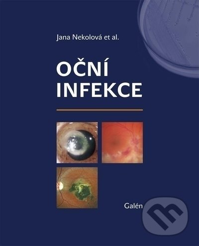 Kniha: Oční infekce (Jana Nekolová). Galén, 2021 Kniha: Oční infekce (Jana Nekolová). Galén, 2021