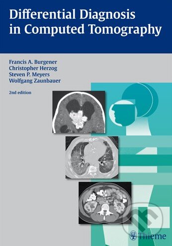 Kniha: Differential Diagnosis in Computed Tomography (Francis A. Burgener). Thieme, 2011 Kniha: Differential Diagnosis in Computed Tomography (Francis A. Burgener). Thieme, 2011