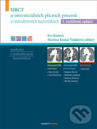Kniha: HRCT u intersticiálních plicních procesů v instruktivních kazuistikách (Eva Kočová, Martina Koziar Vašáková a kolektív). Maxdorf, 2022 Kniha: HRCT u intersticiálních plicních procesů v instruktivních kazuistikách (Eva Kočová, Martina Koziar Vašáková a kolektív). Maxdorf, 2022