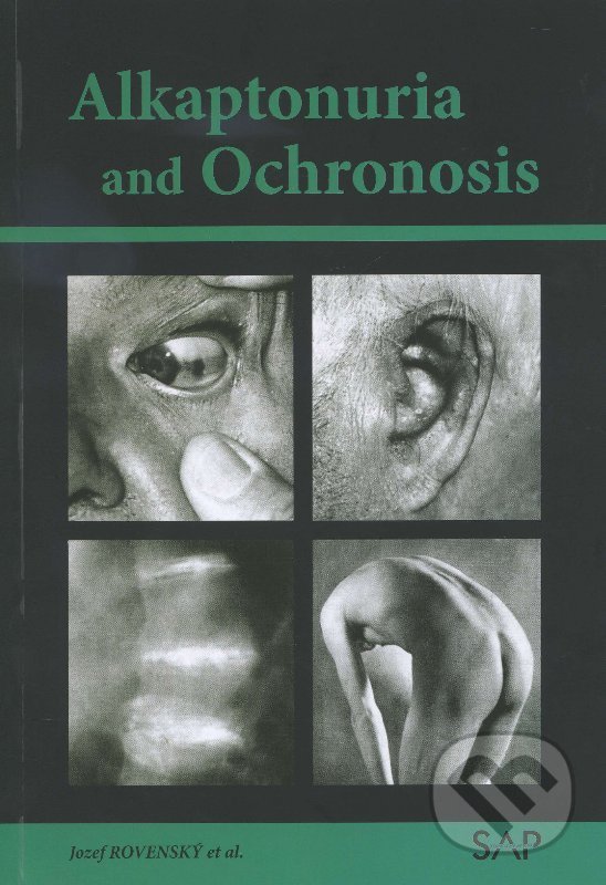 Kniha: Alkaptonuria and ochronosi (Jozef Rovenský). Slovak Academic Press, 2013 Kniha: Alkaptonuria and ochronosi (Jozef Rovenský). Slovak Academic Press, 2013