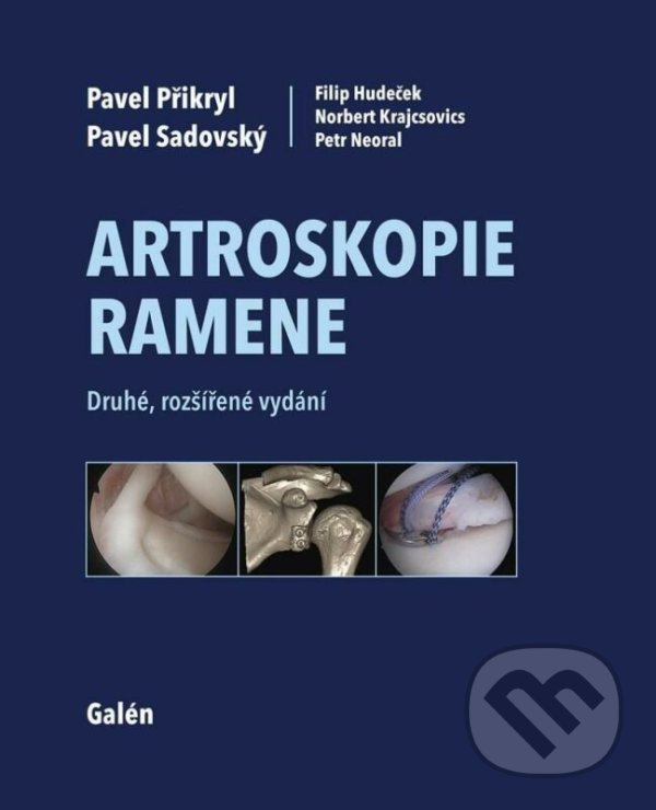 Kniha: Artroskopie ramene (Pavel Přikryl, Pavel Sadovský, Filip Hudeček, Norbert Krajcsovics a Petr Neoral). Galén, 2022 Kniha: Artroskopie ramene (Pavel Přikryl, Pavel Sadovský, Filip Hudeček, Norbert Krajcsovics a Petr Neoral). Galén, 2022