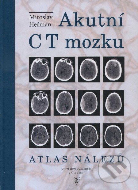 Kniha: Akutní CT mozku (Miroslav Heřman). Univerzita Palackého v Olomouci, 2006 Kniha: Akutní CT mozku (Miroslav Heřman). Univerzita Palackého v Olomouci, 2006