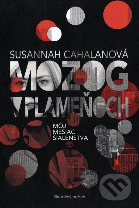 Kniha: Mozog v plameňoch (Susannah Cahalan). Fortuna Libri, 2013 Kniha: Mozog v plameňoch (Susannah Cahalan). Fortuna Libri, 2013