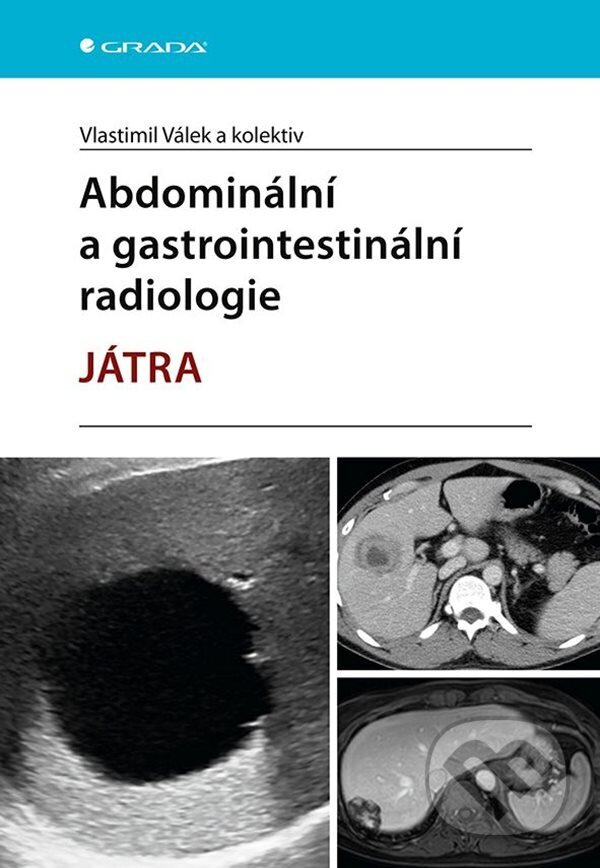 E-kniha: Abdominální a gastrointestinální radiologie (Vlastimil Válek a kolektív). Grada, 2023 E-kniha: Abdominální a gastrointestinální radiologie (Vlastimil Válek a kolektív). Grada, 2023