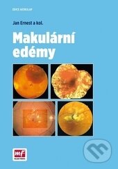 Kniha: Makulární edémy (Jan Ernest). Mladá fronta, 2014 Kniha: Makulární edémy (Jan Ernest). Mladá fronta, 2014