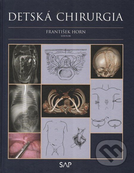 Kniha: Detská chirurgia (František Horn). Slovak Academic Press, 2014 Kniha: Detská chirurgia (František Horn). Slovak Academic Press, 2014