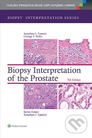 Kniha: Biopsy Interpretation of the Liver (Michael Torbenson). Lippincott Williams & Wilkins, 2014 Kniha: Biopsy Interpretation of the Liver (Michael Torbenson). Lippincott Williams & Wilkins, 2014