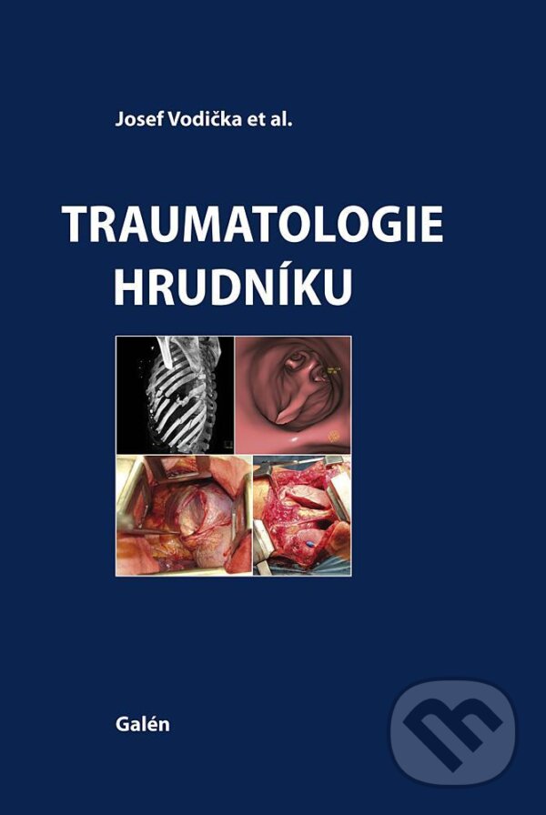Kniha: Traumatologie hrudníku (Josef Vodička). Galén, 2015 Kniha: Traumatologie hrudníku (Josef Vodička). Galén, 2015