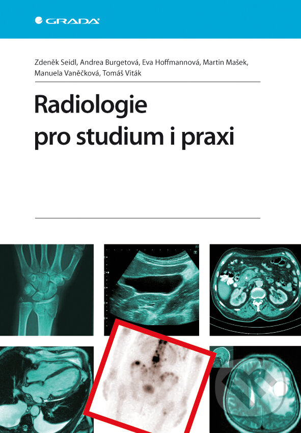 Radiologie pro studium i praxi - Zdeněk Seidl a kolektív, Grada, 2012