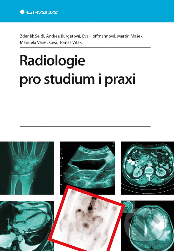 E-kniha: Radiologie pro studium i praxi (Autorský kolektiv a Zdeněk Seidl). Grada, 2012 E-kniha: Radiologie pro studium i praxi (Autorský kolektiv a Zdeněk Seidl). Grada, 2012