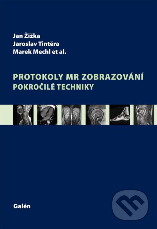 Protokoly MR zobrazování - Jan Žižka, Jaroslav Tintěra, Marek Mechl, Galén, 2015