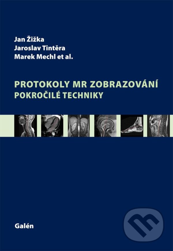 Kniha: Protokoly MR zobrazování (Jan Žižka, Jaroslav Tintěra a Marek Mechl). Galén, 2015 Kniha: Protokoly MR zobrazování (Jan Žižka, Jaroslav Tintěra a Marek Mechl). Galén, 2015