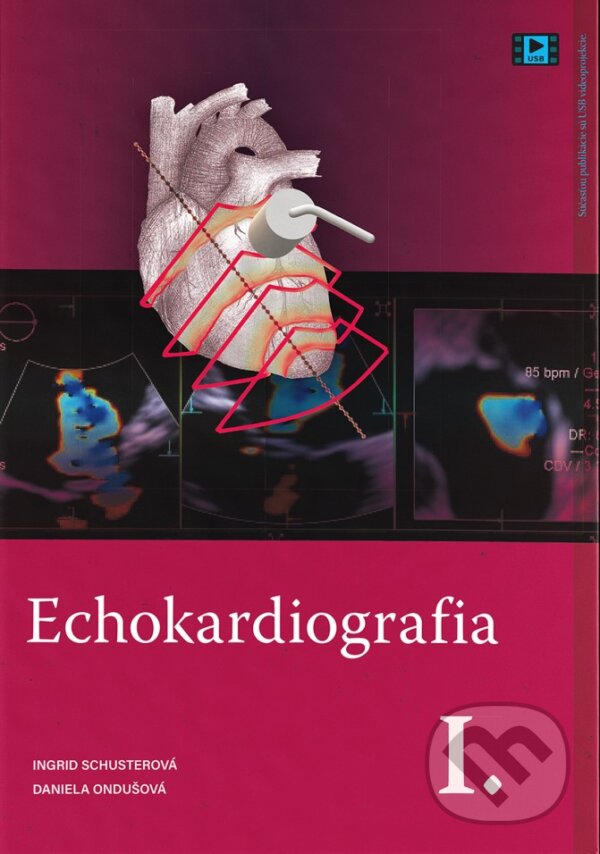 Echokardiografia I. - Ingrid Schusterová, Daniela Ondušová, EQUILIBRIA, 2023
