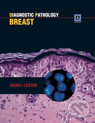 Kniha: Diagnostic Pathology: Breast (David G. Hicks Susan C. Lester). Amirsys, 2011 Kniha: Diagnostic Pathology: Breast (David G. Hicks Susan C. Lester). Amirsys, 2011