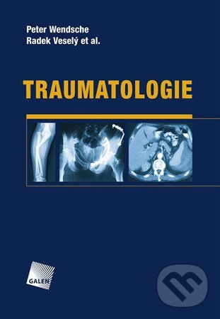 Kniha: Traumatologie (Peter Wendsche a Radek Veselý). Galén, 2015 Kniha: Traumatologie (Peter Wendsche a Radek Veselý). Galén, 2015