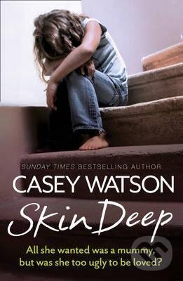 Kniha: Skin Deep (Casey Watson). HarperCollins, 2015 Kniha: Skin Deep (Casey Watson). HarperCollins, 2015