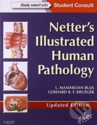 Kniha: Netter's Illustrated Human Pathology (Gerhard R.F. Krueger a L. Maximilian Buja). Saunders, 2013 Kniha: Netter's Illustrated Human Pathology (Gerhard R.F. Krueger a L. Maximilian Buja). Saunders, 2013