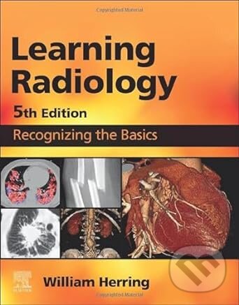 Kniha: Learning Radiology (William Herring). Elsevier Science, 2023 Kniha: Learning Radiology (William Herring). Elsevier Science, 2023