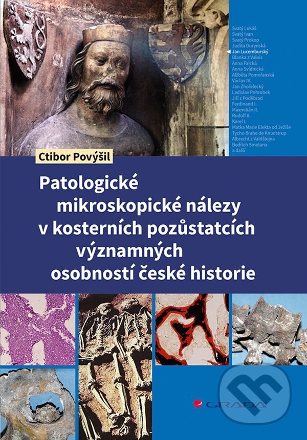 E-kniha: Patologické mikroskopické nálezy v kosterních pozůstatcích významných osobností české historie (Ctibor Povýšil). Grada, 2024 E-kniha: Patologické mikroskopické nálezy v kosterních pozůstatcích významných osobností české historie (Ctibor Povýšil). Grada, 2024