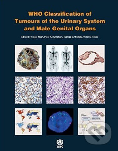 WHO Classification of Tumours of the Urinary System and Male Genital Organs - Holger Moch a kol., World Health Organization, 2016