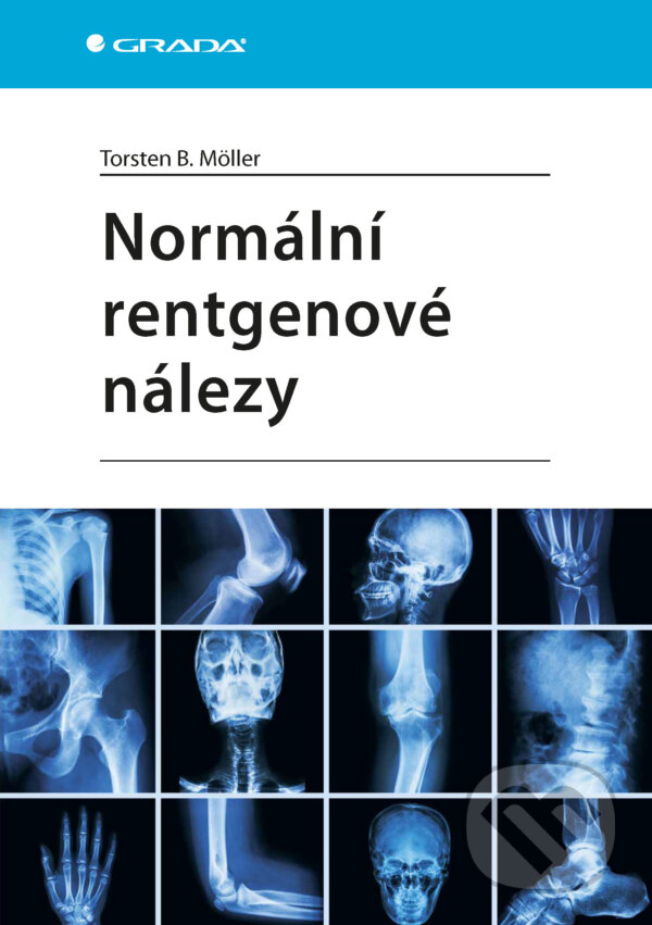 E-kniha: Normální rentgenové nálezy (Möller Torsten B.). Grada, 2025 E-kniha: Normální rentgenové nálezy (Möller Torsten B.). Grada, 2025