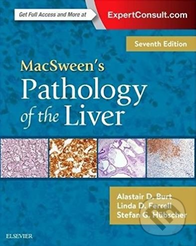 MacSween&#039;s Pathology of the Liver - Alastair D. Burt, Linda D. Ferrell, Stefan G. Hubscher, Elsevier Science, 2017