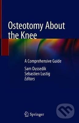 Kniha: Osteotomy About the Knee : A Comprehensive Guide (Sam Oussedik). Springer Nature Switzerland, 2020 Kniha: Osteotomy About the Knee : A Comprehensive Guide (Sam Oussedik). Springer Nature Switzerland, 2020