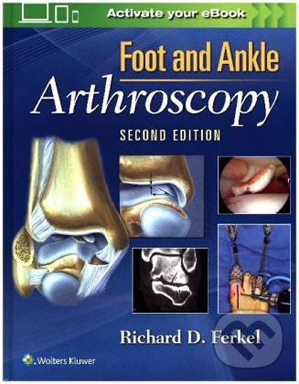 Kniha: Foot & Ankle Arthroscopy, 2nd Ed. (Lippincott Williams & Wilkins). Lippincott Williams & Wilkins Kniha: Foot & Ankle Arthroscopy, 2nd Ed. (Lippincott Williams & Wilkins). Lippincott Williams & Wilkins