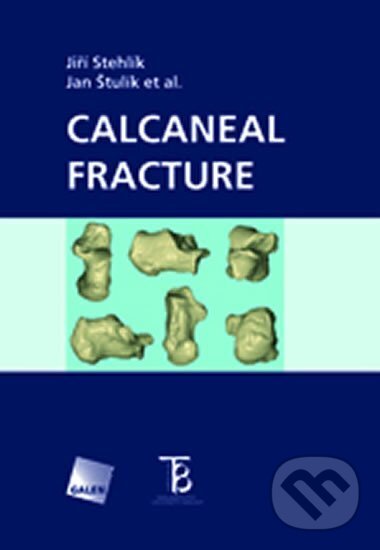 Kniha: Calcaneal Fracture (Jiří Stehlík). Karolinum, 2013 Kniha: Calcaneal Fracture (Jiří Stehlík). Karolinum, 2013