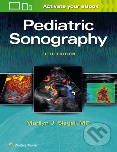 Kniha: Pediatric Sonography (Marilyn J. Siegel). Lippincott Williams & Wilkins, 2018 Kniha: Pediatric Sonography (Marilyn J. Siegel). Lippincott Williams & Wilkins, 2018