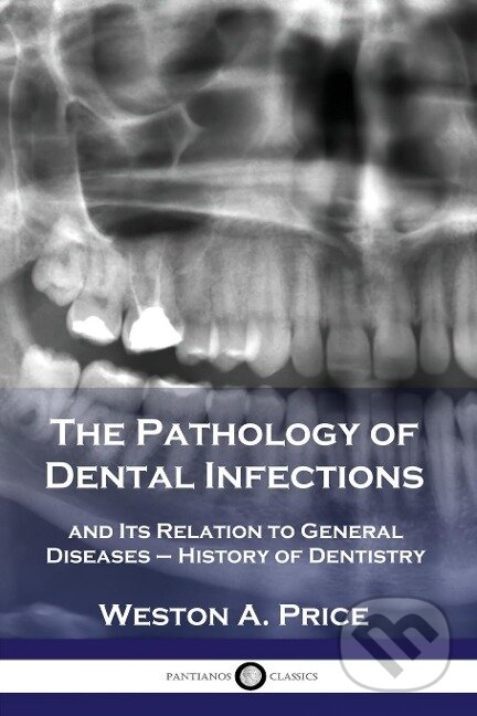 Kniha: The Pathology of Dental Infections (Weston A. Price). , 1916 Kniha: The Pathology of Dental Infections (Weston A. Price). , 1916