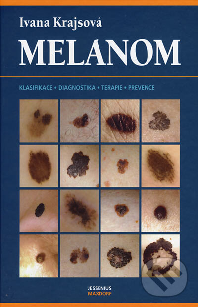 Kniha: Melanom (Ivana Krajsová). Maxdorf, 2006 Kniha: Melanom (Ivana Krajsová). Maxdorf, 2006