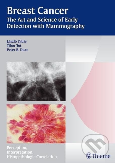 Kniha: Breast Cancer (László Tabár). Georg Thieme Verlag, 2004 Kniha: Breast Cancer (László Tabár). Georg Thieme Verlag, 2004