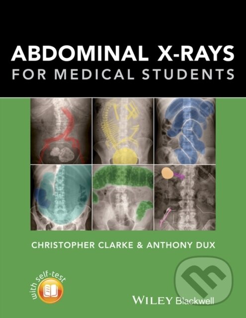 Kniha: Abdominal X-rays for Medical Students (Anthony Dux a Christopher Clarke). Wiley-Blackwell, 2015 Kniha: Abdominal X-rays for Medical Students (Anthony Dux a Christopher Clarke). Wiley-Blackwell, 2015