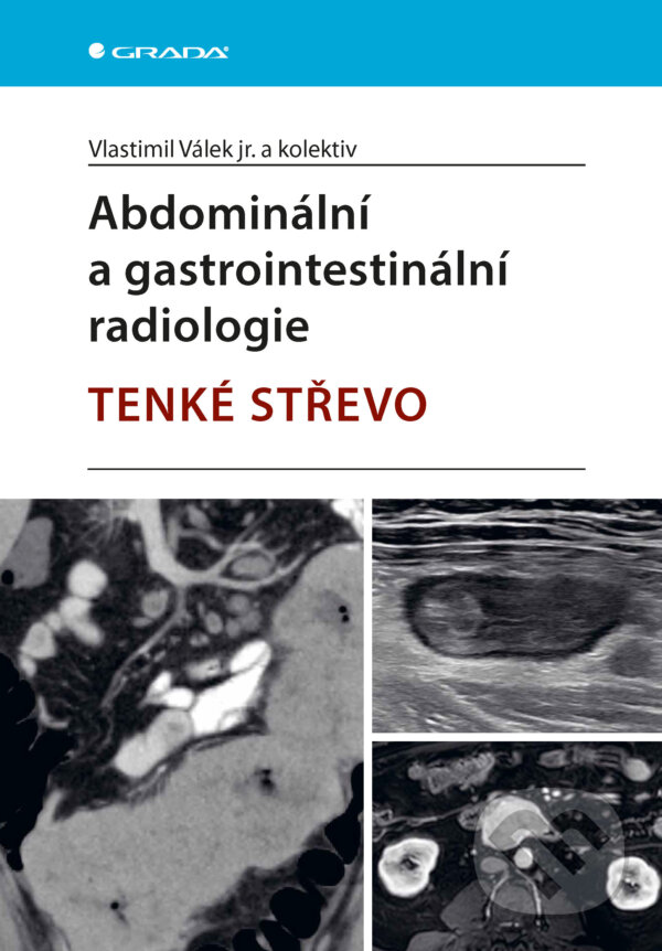 E-kniha: Abdominální a gastrointestinální radiologie (Válek jr. Vlastimil a kolektív). Grada, 2025 E-kniha: Abdominální a gastrointestinální radiologie (Válek jr. Vlastimil a kolektív). Grada, 2025