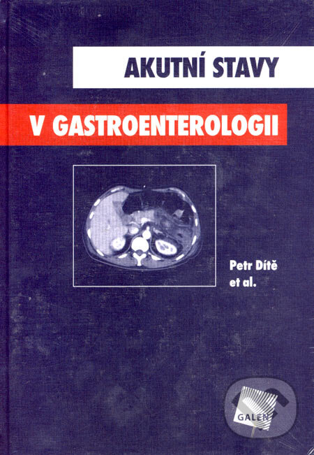 Kniha: Akutní stavy v gastroenterologii (Petr Dítě). Galén, 2005 Kniha: Akutní stavy v gastroenterologii (Petr Dítě). Galén, 2005