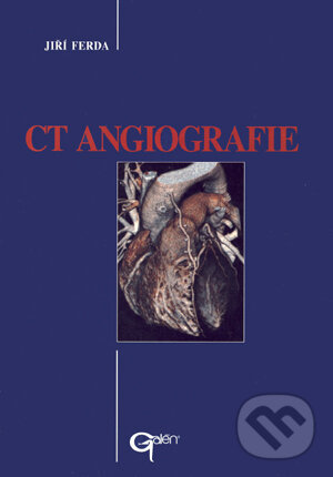Kniha: CT Angiografie (Jiří Ferda). Galén, 2004 Kniha: CT Angiografie (Jiří Ferda). Galén, 2004