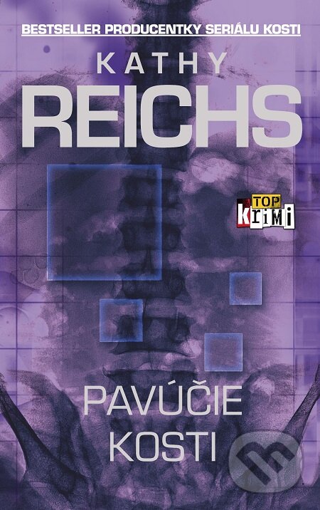 E-kniha: Pavúčie kosti (Kathy Reichs). Slovart, 2018 E-kniha: Pavúčie kosti (Kathy Reichs). Slovart, 2018