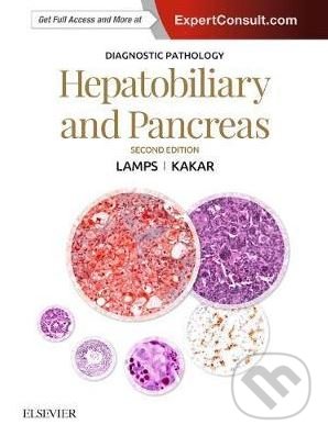 Kniha: Diagnostic Pathology: Hepatobiliary and Pancreas (Laura W. Lamps a Sanjay Kakar). Elsevier Science, 2017 Kniha: Diagnostic Pathology: Hepatobiliary and Pancreas (Laura W. Lamps a Sanjay Kakar). Elsevier Science, 2017