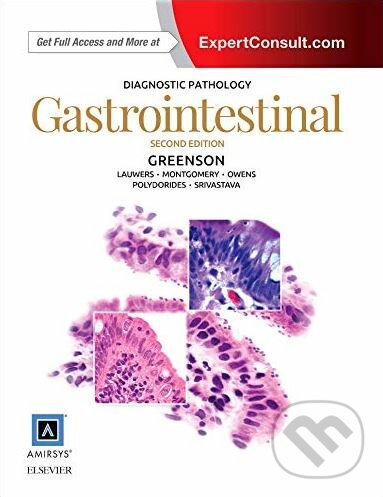 Kniha: Diagnostic Pathology: Gastrointestinal (Joel K. Greenson). Elsevier Science, 2015 Kniha: Diagnostic Pathology: Gastrointestinal (Joel K. Greenson). Elsevier Science, 2015